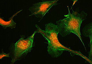 牛肺動脈內皮細胞 - MIchrome CMOS 相機